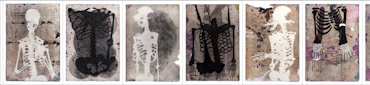 Antibodies