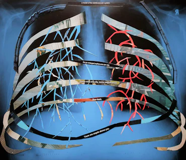 Model of the cardiovascular system