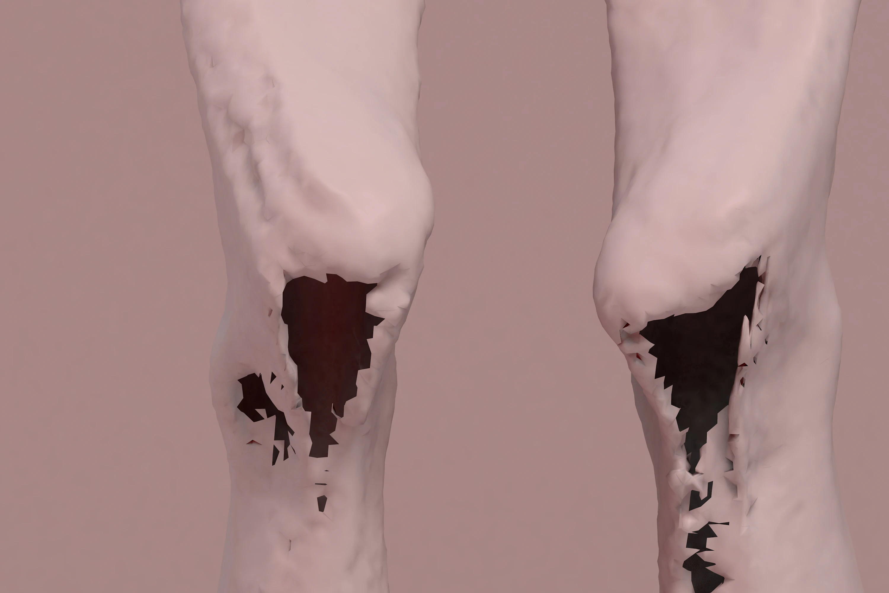 Pain is in the eye of the beholder by Diana Gheorghiu...
