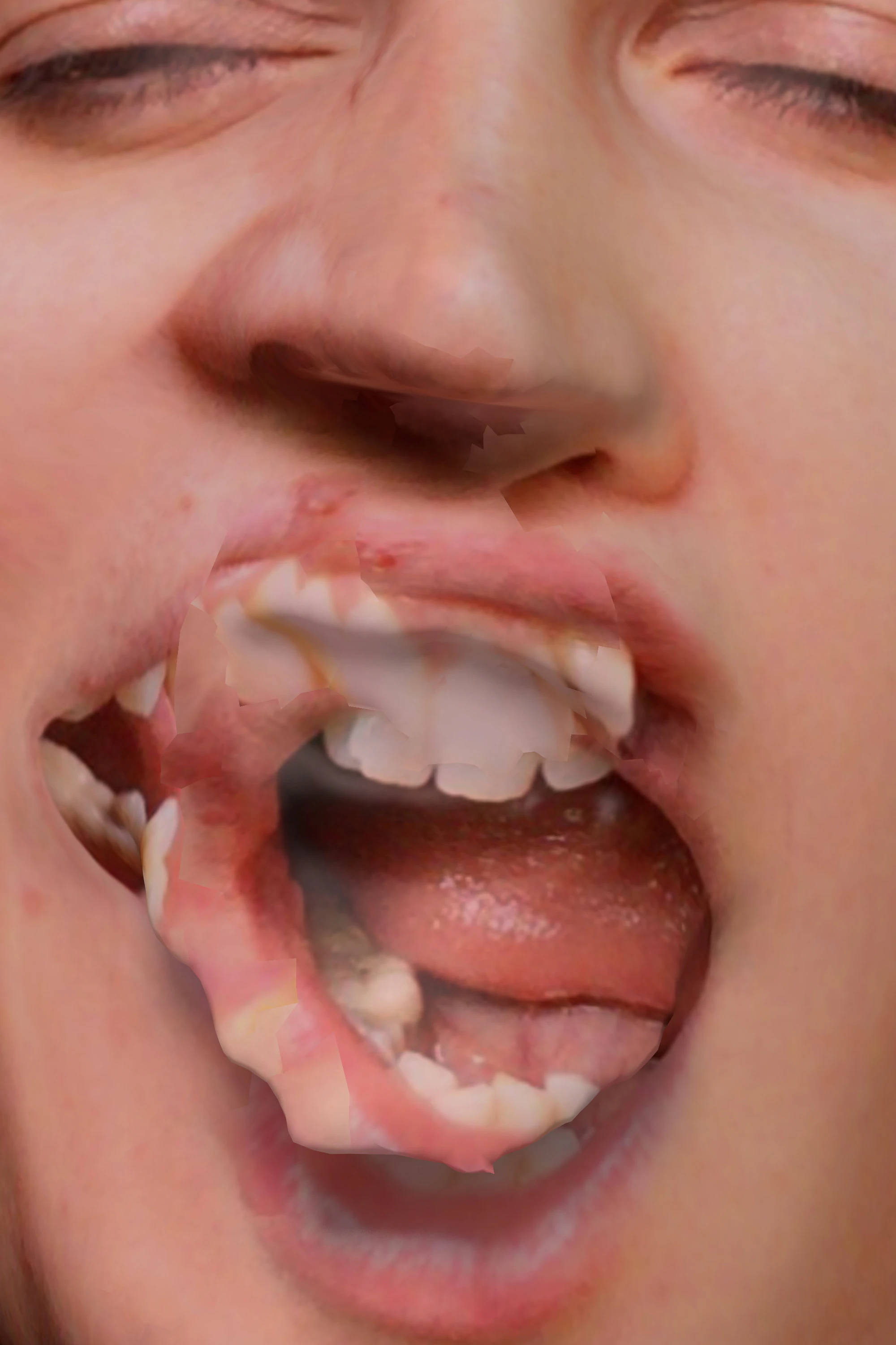 Pain is in the eye of the beholder by Diana Gheorghiu...